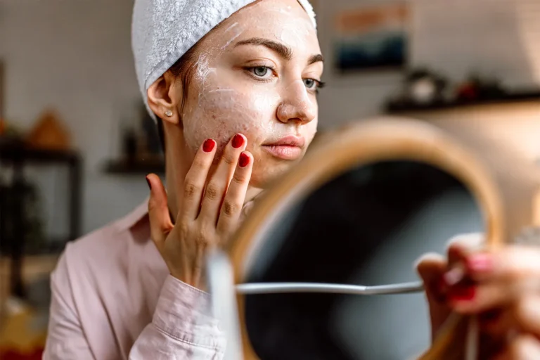 acne vs pimples