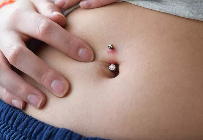 belly button infection antibiotics