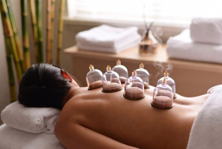 cupping massage