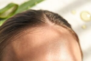 head skin eczema